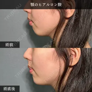 PRISM Beauty Clinic 畑山 知輝医師の症例