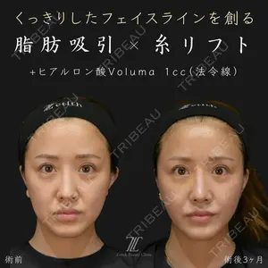 Zetith Beauty Clinic 福岡院 荻野 活医師の症例