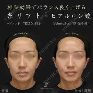 Zetith Beauty Clinic 福岡院 荻野 活医師の症例