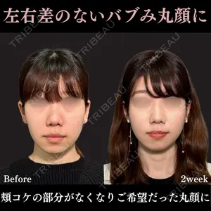 PRISM Beauty Clinic 畑山 知輝医師の症例