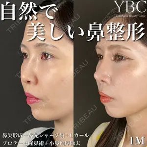 YBC横浜美容外科 大宮院 磯村 亮輔医師の症例