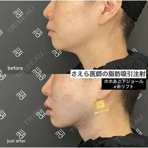 EMMO FACE CLINIC 大阪梅田院 山﨑 冴羅医師の症例