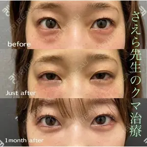 EMMO FACE CLINIC 大阪梅田院 山﨑 冴羅医師の症例