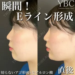 YBC横浜美容外科 大宮院 磯村 亮輔医師の症例