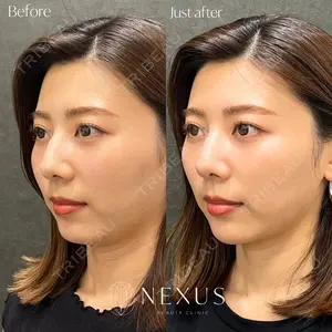 NEXUS CLINICの症例