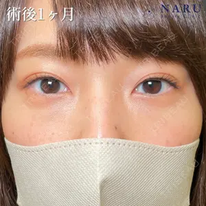 NARU Beauty Clinic 【ナルクリ】 地引 輔医師の症例