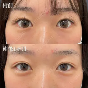 NARU Beauty Clinic 【ナルクリ】 地引 輔医師の症例