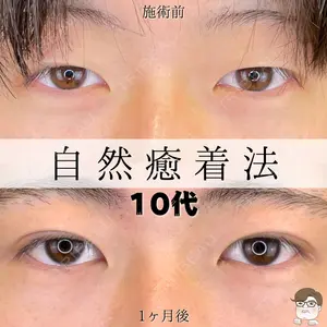 ルラ美容クリニック 札幌院 佐藤 雄紀医師の症例