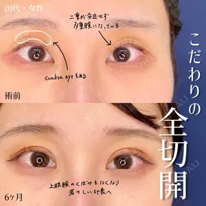 東京シンデレラ美容外科 大宮院の症例