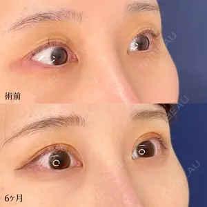 東京シンデレラ美容外科 大宮院の症例
