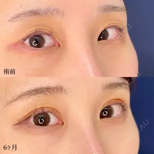 東京シンデレラ美容外科 大宮院の症例