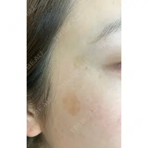 X CLINIC 恵比寿院 辻村 梢医師の症例