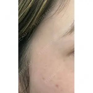 X CLINIC 恵比寿院 辻村 梢医師の症例