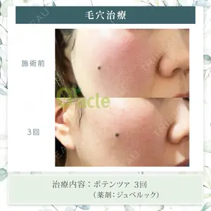 オラクル美容皮膚科 東京新宿院の症例