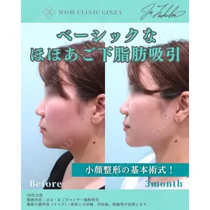 WOM CLINIC GINZA （ワム クリニック ギンザ） 深堀 純也医師の症例