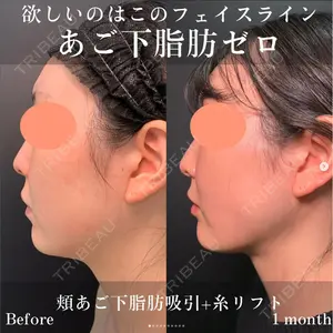 eskin & eclinic 富山院 張田 修平医師の症例