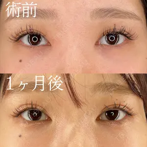 HAAB×DREAM BEAUTY CLINIC 大阪梅田院 柏木 太雅医師の症例