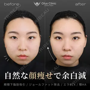 Otus Clinic 【オータスクリニック】 中 徳太郎医師の症例