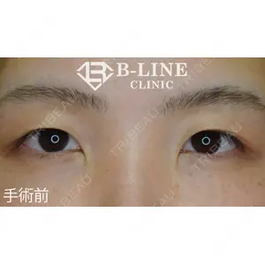 B-LINE CLINIC 池袋院 小池 康弘医師の症例