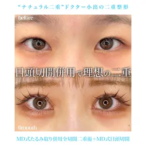 東京シンデレラ美容外科 池袋院 小出 真哉医師の症例