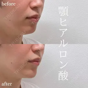 AYANAフィラーズクリニック 武蔵小杉院 吉村 衣里子医師の症例