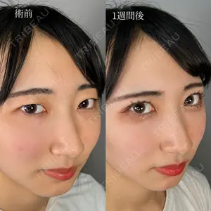 ASTRA BEAUTY CLINIC 河口 はるか医師の症例