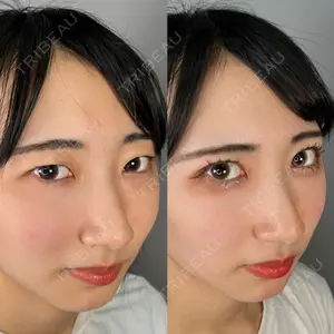 ASTRA BEAUTY CLINIC 河口 はるか医師の症例