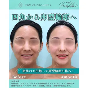 WOM CLINIC GINZA （ワム クリニック ギンザ） 深堀 純也医師の症例
