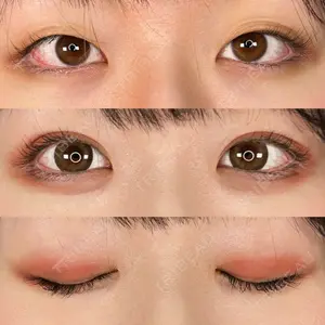 ASTRA BEAUTY CLINIC 河口 はるか医師の症例