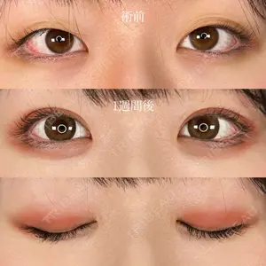 ASTRA BEAUTY CLINIC 河口 はるか医師の症例