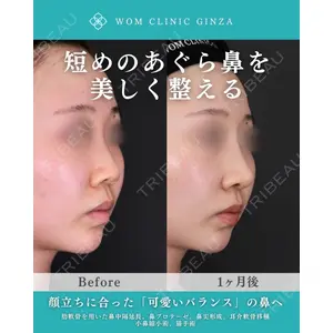 WOM CLINIC GINZA （ワム クリニック ギンザ） 中井 孝昌医師の症例