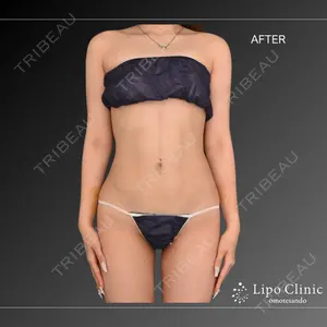 Lipo Clinic omotesando 福田 越医師の症例