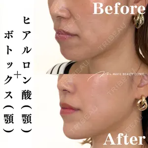 Mavie Beauty Clinic （マヴィービューティークリニック）の症例