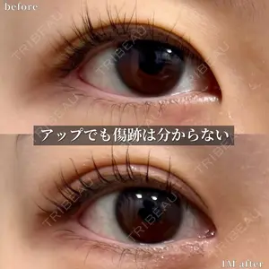 グローバルビューティークリニック 大阪院の症例