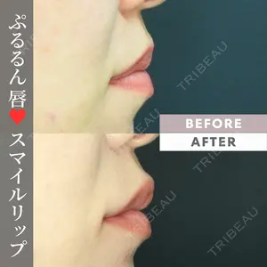 コスメディカルクリニック シンシア 渋谷院の症例