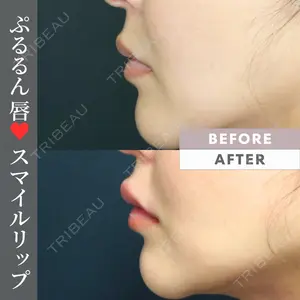 コスメディカルクリニック シンシア 渋谷院の症例