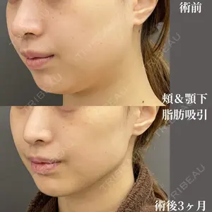 吉井クリニック 吉井 健吾医師の症例