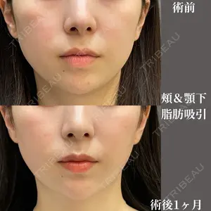 吉井クリニック 吉井 健吾医師の症例