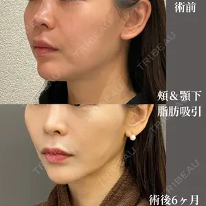 吉井クリニック 吉井 健吾医師の症例
