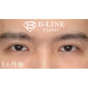 B-LINE CLINIC 池袋院 小池 康弘医師の症例