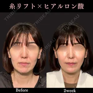 PRISM Beauty Clinic 畑山 知輝医師の症例