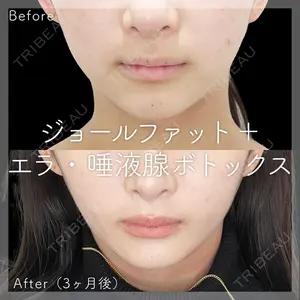 SK新宿歌舞伎町美容外科・歯科の症例
