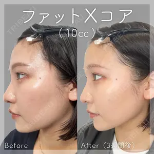 SK新宿歌舞伎町美容外科・歯科の症例