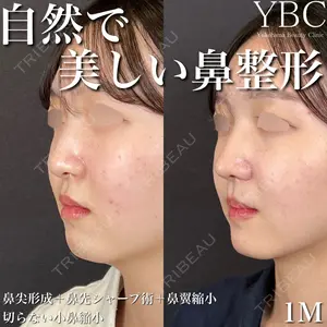 YBC横浜美容外科 大宮院 磯村 亮輔医師の症例