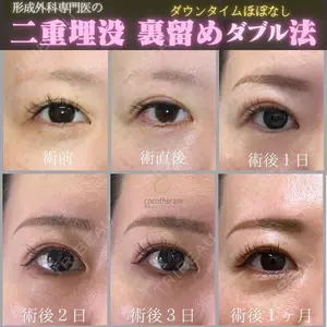 東京ココセランクリニック 篠﨑 智公医師の症例