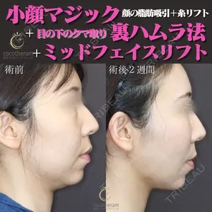 東京ココセランクリニック 篠﨑 智公医師の症例