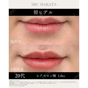 湘南美容クリニック 博多院 西川 菜穂子医師の症例