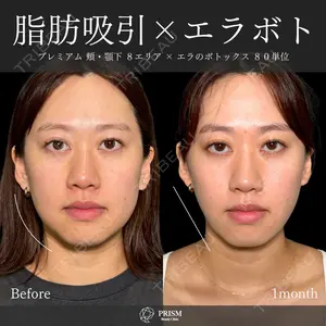 PRISM Beauty Clinic 新宿院 畑山 知輝医師の症例