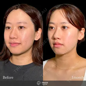 PRISM Beauty Clinic 新宿院 畑山 知輝医師の症例