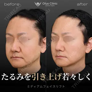 Otus Clinic 【オータスクリニック】 中 徳太郎医師の症例